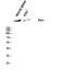 ATM Serine/Threonine Kinase antibody, A00014-1, Boster Biological Technology, Western Blot image 