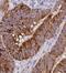 Autophagy Related 16 Like 1 antibody, FNab00669, FineTest, Immunohistochemistry paraffin image 