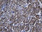 Solute Carrier Family 39 Member 5 antibody, LS-C799682, Lifespan Biosciences, Immunohistochemistry paraffin image 