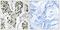 Zinc finger CCCH domain-containing protein 4 antibody, PA5-39541, Invitrogen Antibodies, Immunohistochemistry paraffin image 