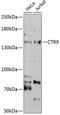 CTR9 Homolog, Paf1/RNA Polymerase II Complex Component antibody, 19-125, ProSci, Western Blot image 