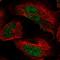 AT-Rich Interaction Domain 2 antibody, HPA063044, Atlas Antibodies, Immunofluorescence image 