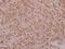 Protein Kinase AMP-Activated Catalytic Subunit Alpha 1 antibody, A00994S486, Boster Biological Technology, Immunohistochemistry paraffin image 