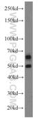 Calcium/Calmodulin Dependent Protein Kinase II Beta antibody, 11533-1-AP, Proteintech Group, Western Blot image 