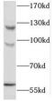 Mitogen-Activated Protein Kinase Kinase Kinase Kinase 5 antibody, FNab04984, FineTest, Western Blot image 