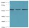 Myotilin antibody, LS-C376192, Lifespan Biosciences, Western Blot image 