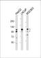 Anoctamin 7 antibody, 63-938, ProSci, Western Blot image 