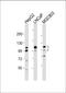 Anoctamin-7 antibody, 63-938, ProSci, Western Blot image 