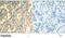 Signal Transducer And Activator Of Transcription 2 antibody, LS-C203091, Lifespan Biosciences, Immunohistochemistry paraffin image 