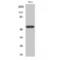 ETS Variant 6 antibody, LS-C386369, Lifespan Biosciences, Western Blot image 