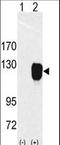 Receptor Tyrosine Kinase Like Orphan Receptor 1 antibody, LS-C99122, Lifespan Biosciences, Western Blot image 