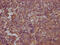 Ras Homolog Family Member A antibody, CSB-RA546523A0HU, Cusabio, Immunohistochemistry paraffin image 
