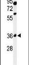 Glycosyltransferase 8 Domain Containing 2 antibody, PA5-24656, Invitrogen Antibodies, Western Blot image 