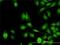 Zinc Finger Protein 622 antibody, H00090441-M02, Novus Biologicals, Immunofluorescence image 