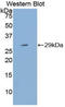 Cytochrome P450 Family 21 Subfamily A Member 2 antibody, LS-C293635, Lifespan Biosciences, Western Blot image 