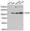 Thyroid Stimulating Hormone Receptor antibody, LS-C334945, Lifespan Biosciences, Western Blot image 