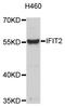 Interferon Induced Protein With Tetratricopeptide Repeats 2 antibody, STJ111444, St John