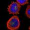 Zinc Finger DHHC-Type Containing 13 antibody, NBP1-83823, Novus Biologicals, Immunofluorescence image 