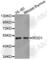 Polypyrimidine Tract Binding Protein 3 antibody, A5952, ABclonal Technology, Western Blot image 