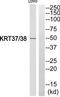 Keratin 38 antibody, TA314792, Origene, Western Blot image 