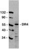 TNF Receptor Superfamily Member 10a antibody, PA1-30795, Invitrogen Antibodies, Western Blot image 