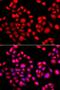 PR/SET Domain 14 antibody, LS-C748696, Lifespan Biosciences, Immunofluorescence image 
