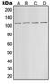 Glutamate Metabotropic Receptor 5 antibody, LS-C352288, Lifespan Biosciences, Western Blot image 