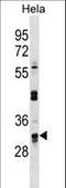 UTP11 antibody, LS-C157337, Lifespan Biosciences, Western Blot image 