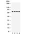 TNF Receptor Superfamily Member 1B antibody, R32001, NSJ Bioreagents, Western Blot image 