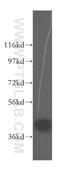 DnaJ Heat Shock Protein Family (Hsp40) Member B5 antibody, 16453-1-AP, Proteintech Group, Western Blot image 