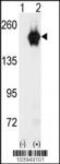 Cyclin G Associated Kinase antibody, MBS9202278, MyBioSource, Western Blot image 