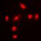 Forkhead Box O1 antibody, orb338819, Biorbyt, Immunofluorescence image 