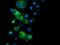Cytochrome B5 Reductase 1 antibody, MA5-25929, Invitrogen Antibodies, Immunocytochemistry image 