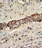 Discoidin Domain Receptor Tyrosine Kinase 2 antibody, LS-C99151, Lifespan Biosciences, Immunohistochemistry paraffin image 