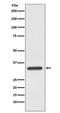 Caspase 7 antibody, M01044, Boster Biological Technology, Western Blot image 
