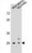 Folate Receptor Beta antibody, abx028532, Abbexa, Western Blot image 