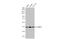 PSA antibody, GTX633629, GeneTex, Western Blot image 