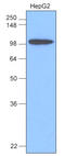 Hexokinase 1 antibody, LS-B2939, Lifespan Biosciences, Western Blot image 