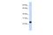 FKBP Prolyl Isomerase 11 antibody, A12952, Boster Biological Technology, Western Blot image 