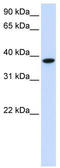 Glycosyltransferase 8 Domain Containing 2 antibody, TA339578, Origene, Western Blot image 