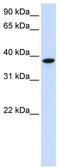 Glycosyltransferase 8 Domain Containing 2 antibody, TA339578, Origene, Western Blot image 