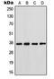Gap junction alpha-4 protein antibody, LS-C353988, Lifespan Biosciences, Western Blot image 