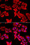 Thyroid Hormone Responsive antibody, STJ29312, St John