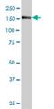 Insulin Receptor Substrate 4 antibody, H00008471-M01, Novus Biologicals, Western Blot image 