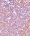 P21 (RAC1) Activated Kinase 2 antibody, NBP1-76720, Novus Biologicals, Immunohistochemistry paraffin image 