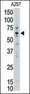 MLLT1 Super Elongation Complex Subunit antibody, 62-162, ProSci, Western Blot image 