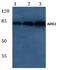 Adducin 2 antibody, A05106-1, Boster Biological Technology, Western Blot image 