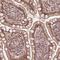 Bromodomain Containing 9 antibody, HPA023197, Atlas Antibodies, Immunohistochemistry paraffin image 