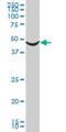 Adrenoceptor Alpha 1A antibody, H00000148-M02, Novus Biologicals, Western Blot image 