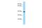 CWC25 Spliceosome Associated Protein Homolog antibody, PA5-45940, Invitrogen Antibodies, Western Blot image 